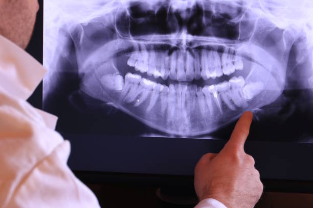 Best Emergency Denture Repair in Lakemoor, IL