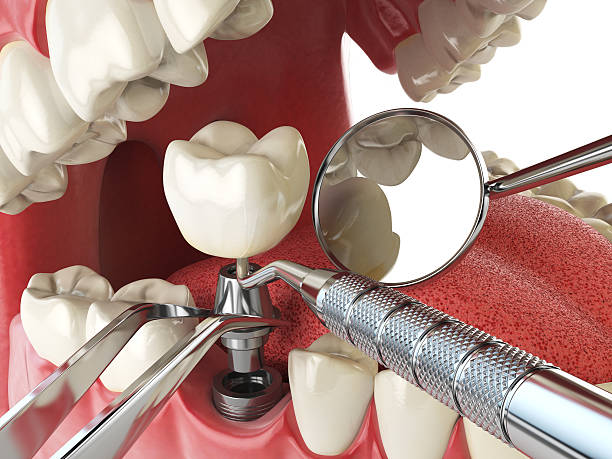 Best Same-Day Emergency Dental Services in Lakemoor, IL